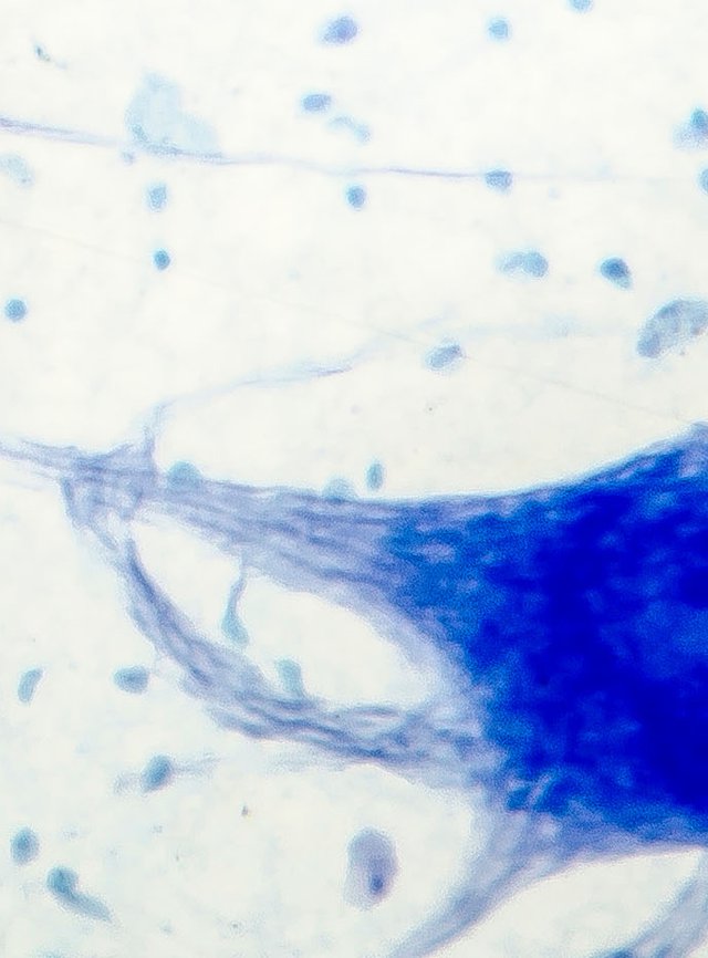 Técnico superior en anatomía patológica y citodiagnóstico