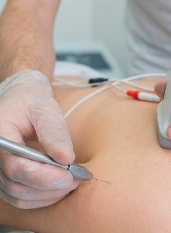 Postgrado de Experto Universitario en Fisioterapia Invasiva para las disfunciones del sistema neuro-musculoesquelético
