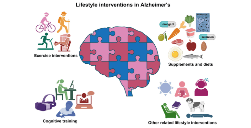 Investigación Alzheimer