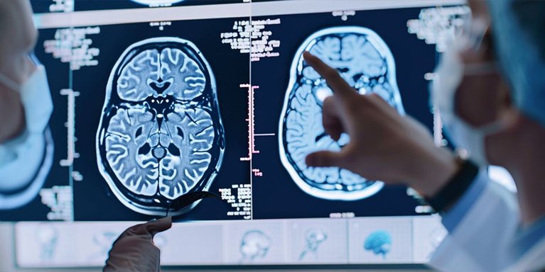 Maestría en Neuropsicología Cognitiva
