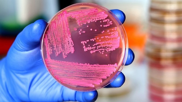 mano de un investigador mostrando una placa de cultivo microbiológico con levaduras probióticas