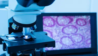 anatomia-patologica-citodiagnostico-salidas-profesionales