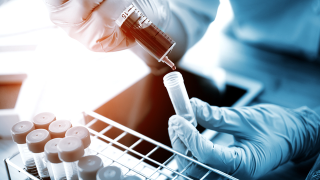 profesional sanitario trabajando con tubos de ensayo en un laboratorio cl&iacute;nico