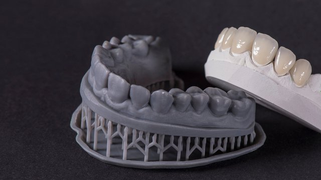 cad-cam-dental