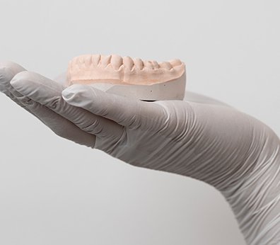 Charla 360º en Implantología: Toma de Decisiones Clínicas con el Sistema Klockner