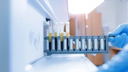 técnico cargando tubos de análisis de suero sanguíneo en la bandeja del analizador clínico para pruebas de diagnóstico
