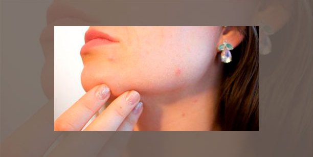 Inscripción completa en el curso de IA en Dermatología