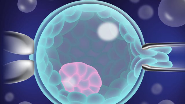 diagnostico genético preimplantacional