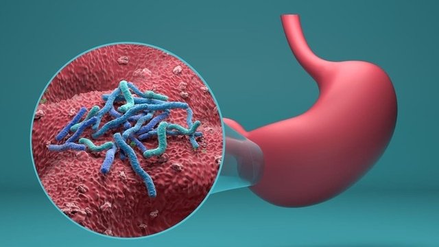 imagen ampliada de cómo es el Helicobacter pylori en el estómago