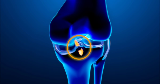 Imagen de un ligamento cruzado anterior