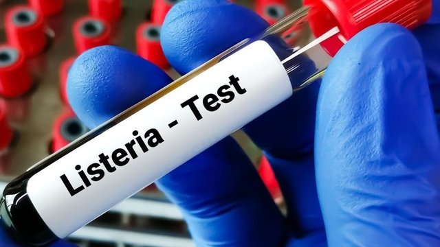 muestra de sangre para análisis de listeria