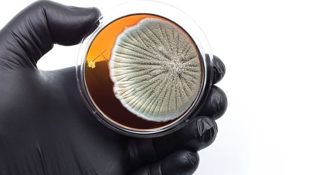 análisis de microbiología