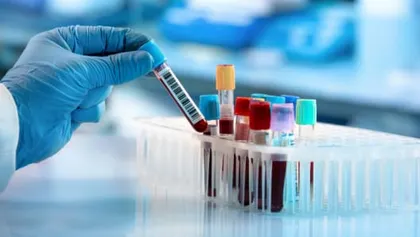 Mano de científico colocando tubos de ensayo con muestras