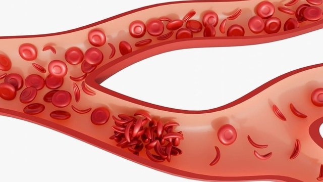 tipo de shock en el riego sanguíneo